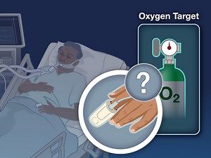 2.7K views · 64 reactions | Roughly one third of critically ill adults receiving mechanical ventilation die in the hospital. The oxygen-saturation target that would optimize outcomes in these patients is unknown. New research findings are summarized in a short video. https://nej.md/3NBsMUX | The New England Journal of Medicine | Facebook