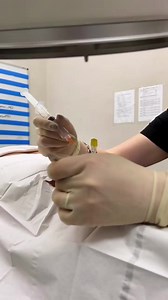 283K views · 1K reactions | Lumbar radiofrequency nerve ablation...