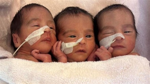 ‘They’re doing great’: Rare Aussie triplets born