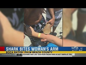 Nurse shark bites woman, gets attached to her arm