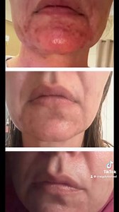 Let me show you what our Skincare is Made of !!!! Its made of AMAZING FREAKEN RESULTS GET YOURS NOW Visit CRAIGLIFESTYLE.com @top fans CraigLifestyle.com @followers #fantalla #craigdutoitnelpage #craigdutoitnel #afrikaans #GlowProducts | Craig Du Toit Nel Page