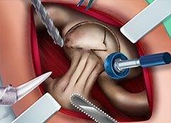 Ella Hip Surgery - Play for free - Online Games