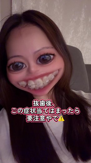 抜歯後の危険な症状と注意点
