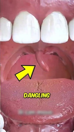 You Have This In Your Throat 😳#shorts
