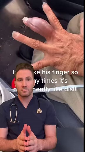 21K views · 102 reactions | Swollen finger. #fingerinfection #osteomyelitis #sarcoma #bonetumor #burn | Mary Johnson | Facebook
