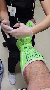 Help Poor Patient Removal Cast Broken Leg So Pain 😱 #castremoval #help #patient #removal #brokenleg