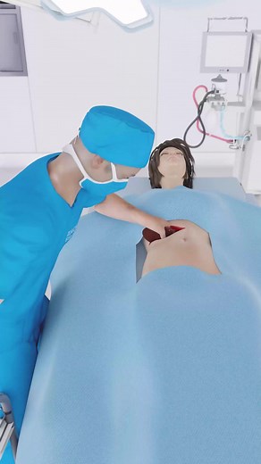 53M views · 479K reactions | Surgeon Brands Patient’s Livers?!  | Zack D. Films | Facebook