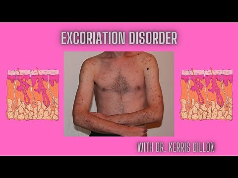 Excoriation Disorder