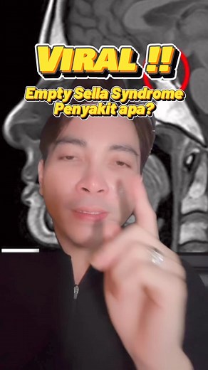 Empty Sella syndrome sempet jadi perbincangan hangat karena ada public figur yang kabarnya menderita penyakit ini#ESS #emptysellasyndrome #beritaviral #beritakesehatan #ekles #drekles | dr.Ekles