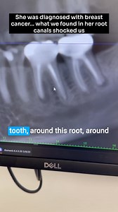 1.8M views · 8.7K reactions | She was just diagnosed with breast...