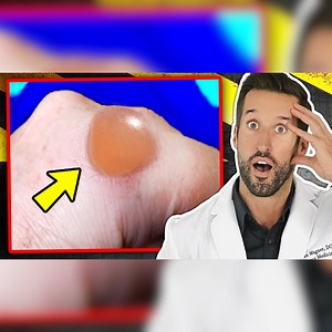 1K views · 78 reactions | 10 Bizarre Body Signs You Shouldn't Ignore | Doctor ER | Facebook