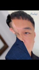 21K views · 60 reactions | #rhinoplasty #goretexrhinoplasty #alarplasty #dalisaymedical | Dalisay Medical and Aesthetics | Facebook