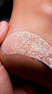 Foot Care Detail | Callus Scraping ASMR RM4S #footcare #heeleexfoliation #pedicure #oddlysatisfying #dryskinremoval Enjoy clean, relaxing foot-care ASMR with gentle heel exfoliation and natural callus removal. Disclaimer: AI-generated educational & relaxation content. | Yorkers
