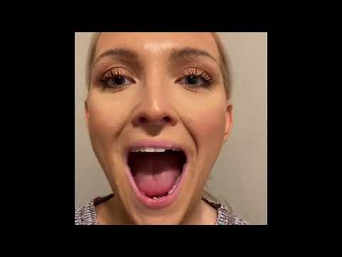 Oral Mech Exam