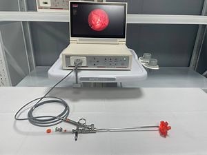 [Hot Item] Rigid Digital Standard Video Nephroscope HD Video Percutaneous Nephrolithotomy