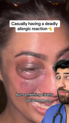 EpiPen: Understanding Its Side Effects and Usage