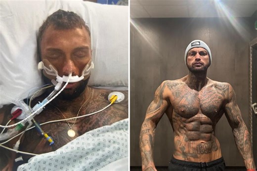 Bodybuilder left in a coma after spending over $46K on steroids