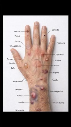 Common Skin Lesions Types with Visual Examples | Dermatology Guide