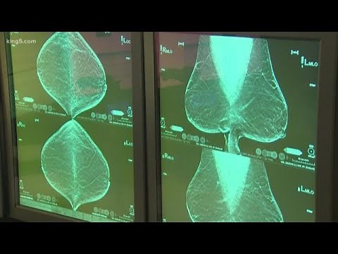 2D vs. 3D mammography