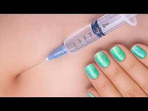 IM Injection 💉 | Step-by-Step Guide to Safe Intramuscular Injection
