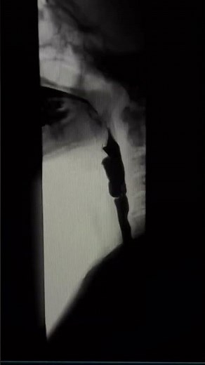 Barium Swallow #radiographer #radiology #fluoroscopy #xray #bariumswallow