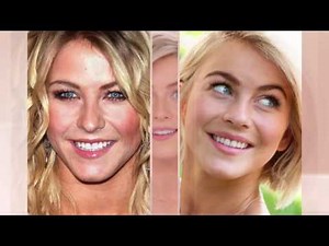 Proactiv Solution - Julianne Hough