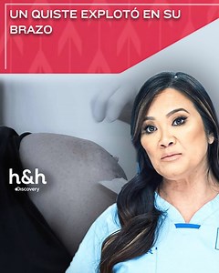 22K views · 240 reactions | Un quiste en su brazo izquierdo no ha parado de crecer desde hace 30 años, la Dra. Lee hará lo posible por removerlo. #DraSandraLee #J | Discovery Home & Health | Facebook