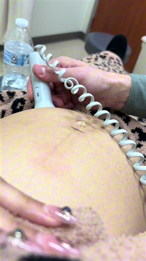 Baby DJ is healthy 🤍 and that’s the biggest blessing of all! As for me, they’re holding off on a preeclampsia diagnosis for now… it looks like my symptoms are more related to anemia and dehydration. I was prescribed another iron supplement, and at my next appointment, if symptoms continue, they’ll start me on aspirin to help prevent early-onset preeclampsia. I finally got to meet my labor & delivery nurse, and she is the sweetest soul 🥹 We’re both so excited about this journey. I also asked ab