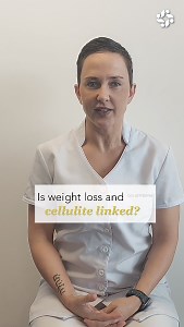 HOW WEIGHT LOSS & CELLULITE ARE CONNECTED Weight loss can have a positive effect on reducing the appearance of cellulite. When you lose weight, your fat cells shrink, and as a result, the dimpled appearance of cellulite can become less noticeable. However, losing weight alone may not be enough to completely eliminate cellulite, especially if you have loose or sagging skin. That's where tightening treatments come in. These treatments, such as radiofrequency and carboxytherapy, can help stimulate 