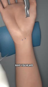 45K views · 216 reactions | Carpal Tunnel Release Surgery (3D Animation) #carpal #carpaltunnel #carpaltunnelpain #carpaltunnelrelief #tunnel #hand #medical3danimation #3dmedicalanimation | Life+Health. | Facebook