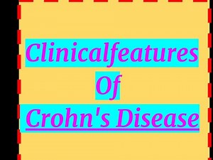Clinical features of Crohn's Disease