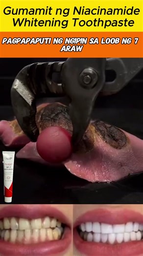 Instant boost for your confidence and your smile! 🦷#whiteningtoothpaste#freshbreath#oralcare#oralhygiene#fyp#tiktokshopblackfriday #tiktokshopcybermonday