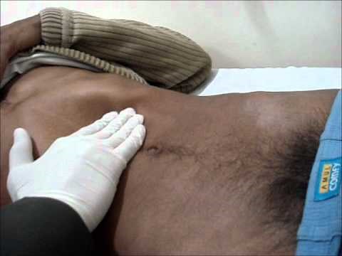 Abdominal Examination, systematic abdominal palpation.