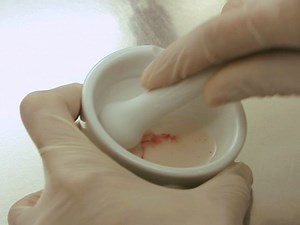 TMEM175 activity in BK-deficient macrophages maintains lysosomal function and mediates silica-induced inflammatory response in macrophages - Watch Related Videos