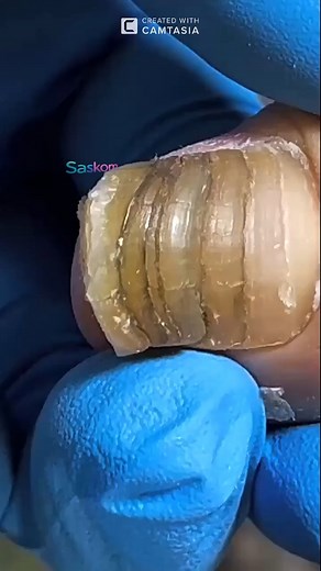 47K views · 274 reactions | Natural Foot Masks for Soft Heels #HeelSoftening #DIYCare - Part 1 | Saskom | Facebook