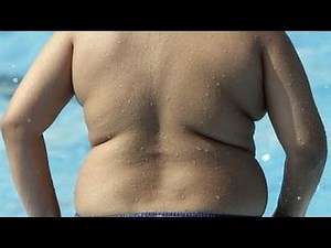 Study: Many overweight teens think they're the right size