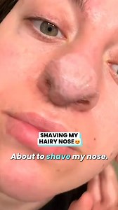 94K views · 122 reactions | The internet is obsessed with my hairy nose  | Ultimate | Facebook