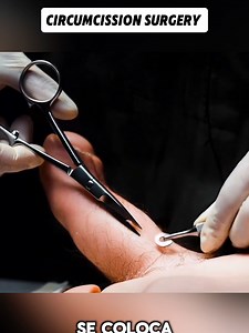 3D Anatomy Visualization for Medical Education