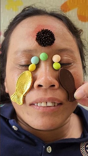 ugly pimple, colorful candy, chocolate candy, goldfish appetizer #sweets #food