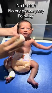 468K views · 3.1K reactions | Delay cry  baby #no breath please pray for baby #newborn #cynosis #nicubaby #viraltiktok | New Born Baby | Facebook