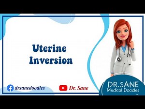 Uterine Inversion ( Something coming out of Vagina ) - Classifications - Degrees - Management