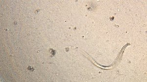 Microscopy of parasite worm nematode (Strongyloides stercoralis). Movement of active parasite infection form in magnification 150x .