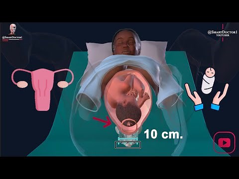 Vaginal Delivery | Labour & Birth 👶🏻🤱🏻