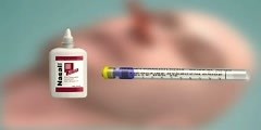 Inserting the Sengstaken Blakemore tube...