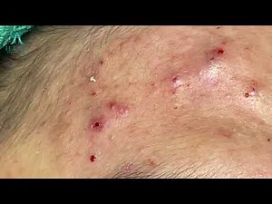 Satisfying Relaxation With Hana Spa #8