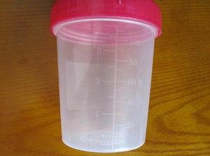 [Hot Item] Medical Container Urine Sample Container for Urine Collection