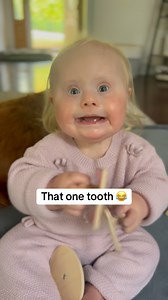 302K views · 22K reactions | Her facial expression plus that one tooth = the cutest thing EVER! #downsyndromeawareness #theluckyfew #downsyndrome | Kristin Walls | Facebook