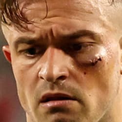 Did Xherdan Shaqiri have a case in Chicago vs. Orlando?