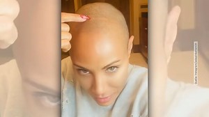 Schauspielerin offenbart sich: Jada Pinkett Smith lebt selbstbewusst mit Haarausfall