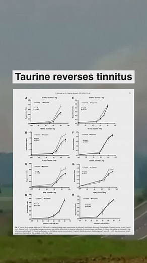 Primarily driven by: ◇ Inflammation ◇ Overexcitation of the auditory neurons. Taurine blocks the main inflammatory pathway in tinnitus (TLR4) & acts as an inhibitory neurotransmitter, combatting excitation. #tinnitus #tinnitushelp #tinnitusrelief #tinnitustreatment #ringingears | Analyze & Optimize